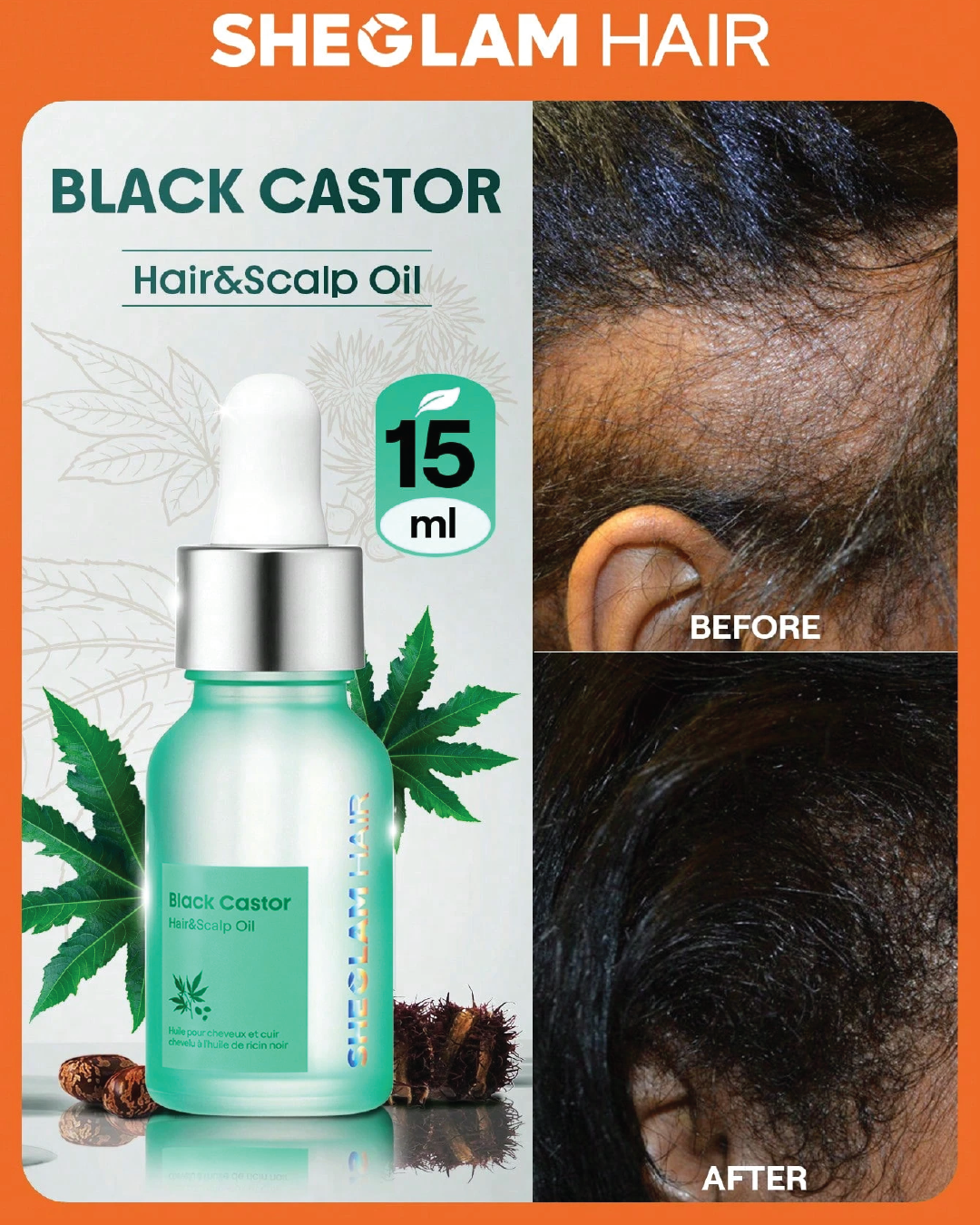 SHEGLAM HAIR Black Castor Hair & Scalp Oil-15ml