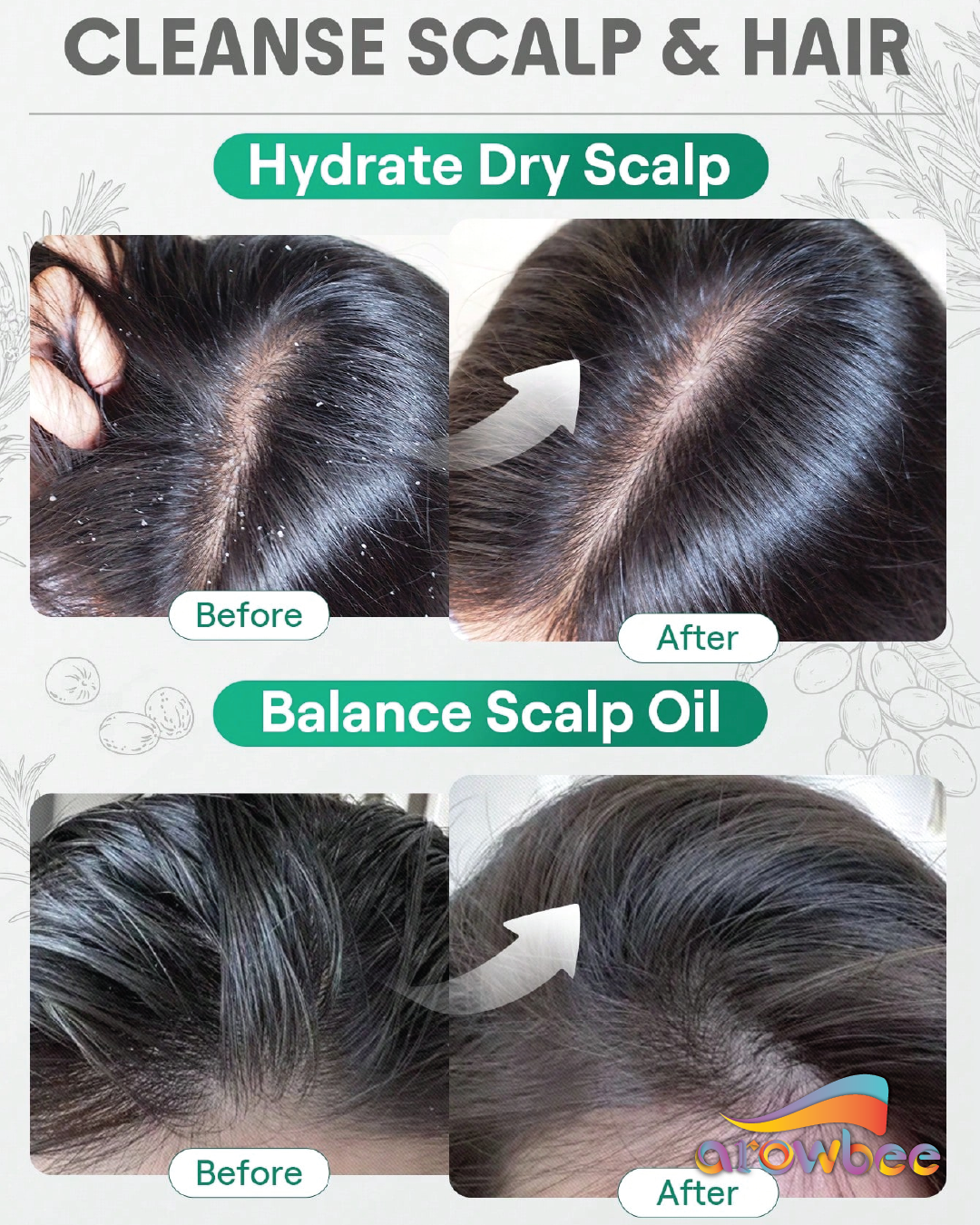 SHEGLAM HAIR Rosemary Hair And Scalp Oil -15ml